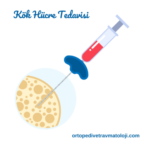Kök Hücre Tedavisi Nedir ve Tedavisi Uygulanır?