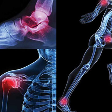 Ortopedi Alanında Doktor Nasıl Seçilmelidir ?
